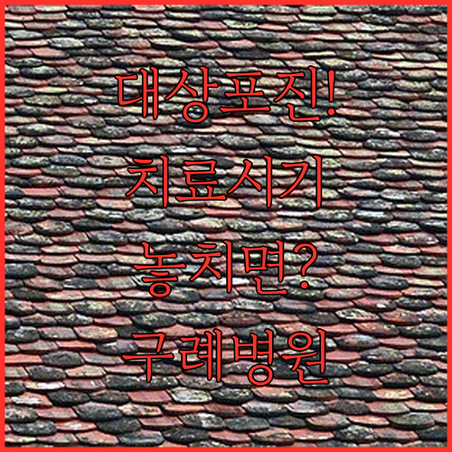 대상포진 치료 시기와 구례 지역 병원 진료 체크리스트